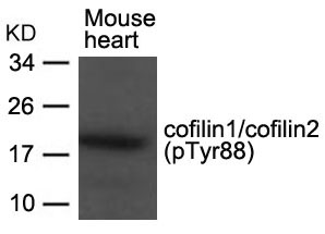 Rabbit Polyclonal Antibody to cofilin1/cofilin2(phospho-Tyr88)