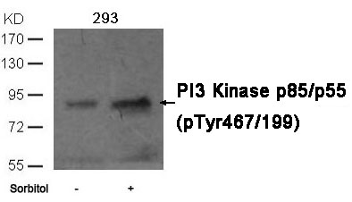 Rabbit Polyclonal Antibody to PI3 Kinase p85/p55 (phospho-Tyr467/199)