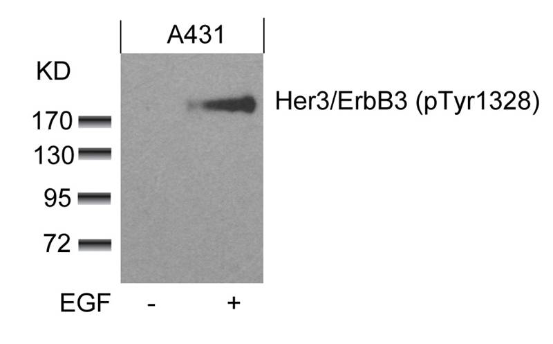 Rabbit Polyclonal Antibody to Her3/ErbB3(phospho-Tyr1328)