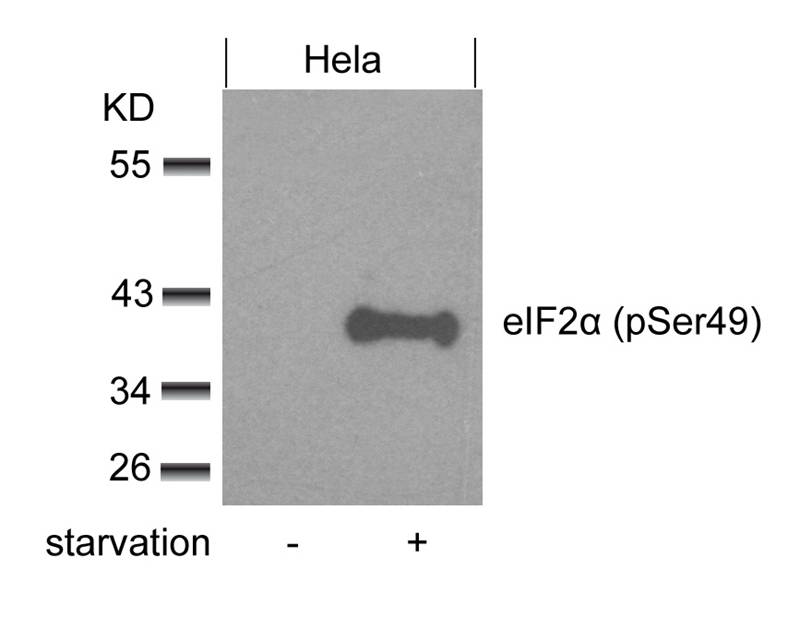 Rabbit Polyclonal Antibody to eIF2a(phospho-Ser49)