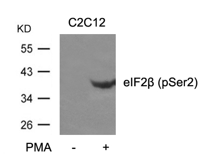 Rabbit Polyclonal Antibody to eIF2b(phospho-Ser2)