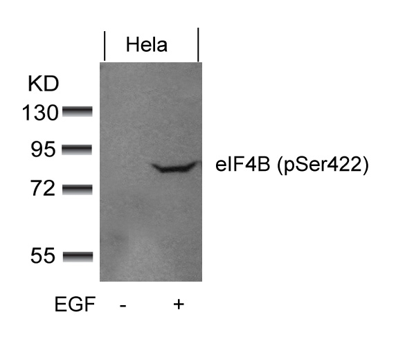 Rabbit Polyclonal Antibody to eIF4B(phospho-Ser422)