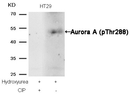 Rabbit Polyclonal Antibody to Aurora A(phospho-Thr288)