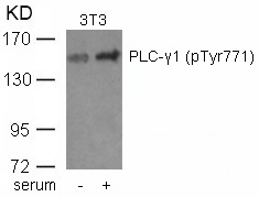 Rabbit Polyclonal Antibody to PLCg1(phospho-Tyr771)