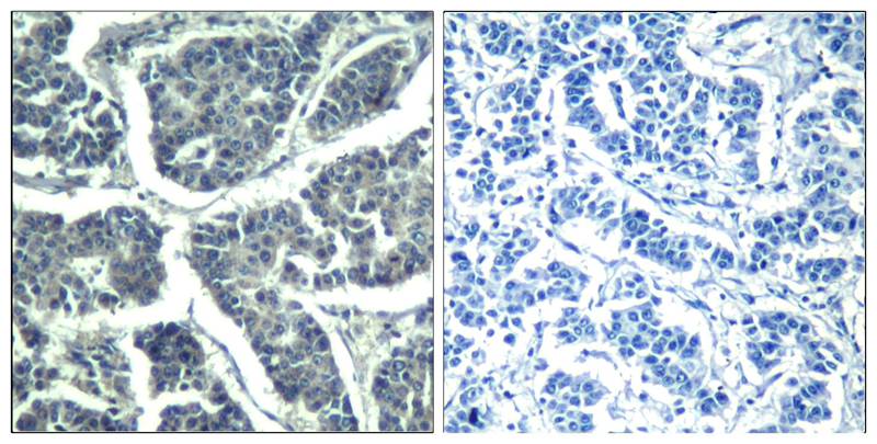 Rabbit Polyclonal Antibody to PLCg2(phospho-Tyr1217)