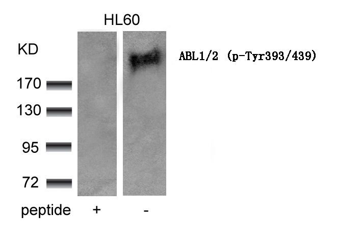 Rabbit Polyclonal Antibody to ABL1/2 (phospho-Tyr393/439)