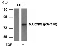 Rabbit Polyclonal Antibody to MARCKS(phospho-Ser170)