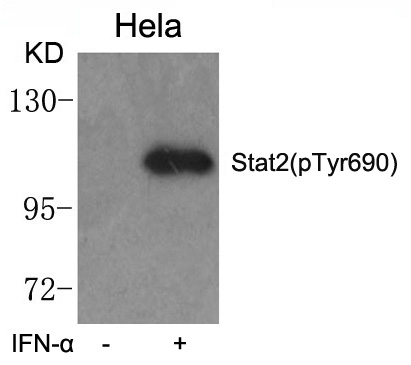 Rabbit Polyclonal Antibody to STAT2(phospho-Tyr690)