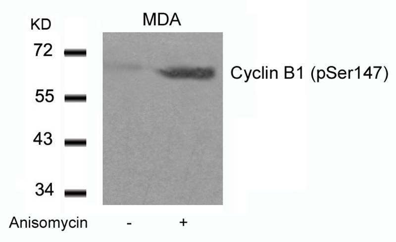 Rabbit Polyclonal Antibody to Cyclin B1(phospho-Ser147)