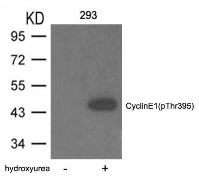 Rabbit Polyclonal Antibody to Cyclin E1(phospho-Thr395)
