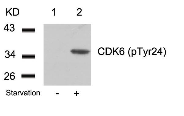 Rabbit Polyclonal Antibody to CDK6(phospho-Tyr24)