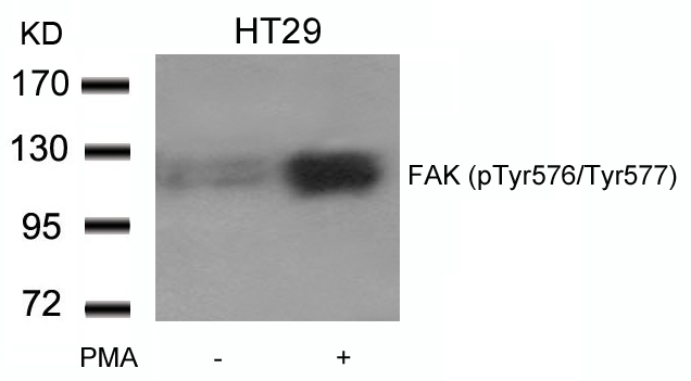 Rabbit Polyclonal Antibody to FAK(phospho-Tyr576/Tyr577)