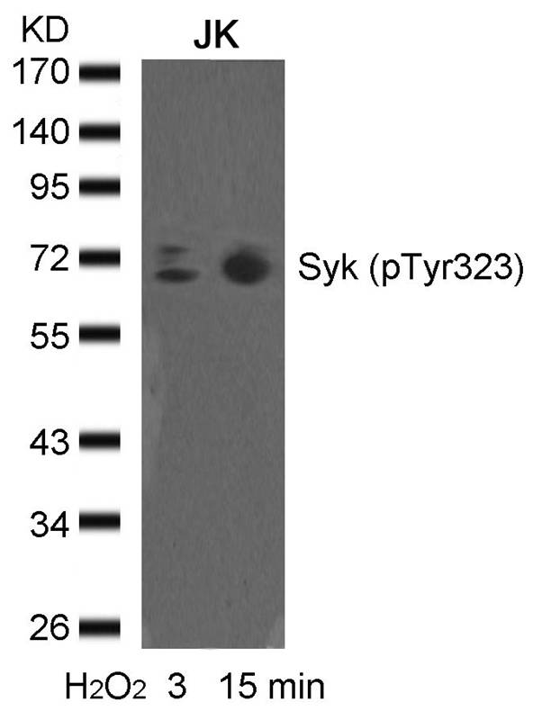 Rabbit Polyclonal Antibody to syk(phospho-Tyr323)