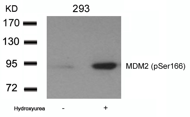 Rabbit Polyclonal Antibody to MDM2(phospho-Ser166)