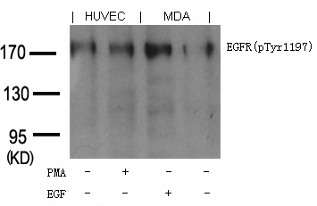 Goat Polyclonal Antibody to EGFR(phospho-Tyr1197) Goat