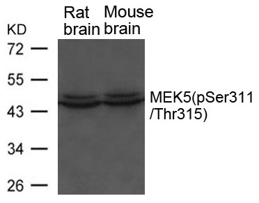 Rabbit Polyclonal Antibody to MEK5(phospho-Ser311/ Thr315)