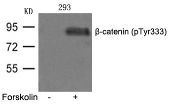 Rabbit Polyclonal Antibody to β-catenin(phospho-Tyr333)