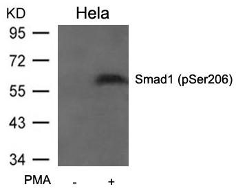 Rabbit Polyclonal Antibody to Smad1(Phospho-Ser206)