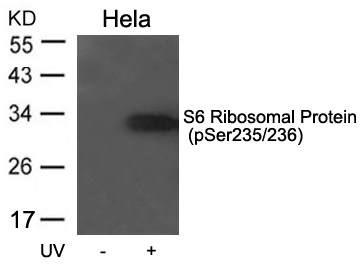 Rabbit Polyclonal Antibody to S6 Ribosomal Protein(Phospho-Ser235/236)