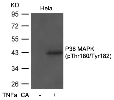 Rabbit Polyclonal Antibody to P38 MAPK(Phospho-Thr180/Tyr182)