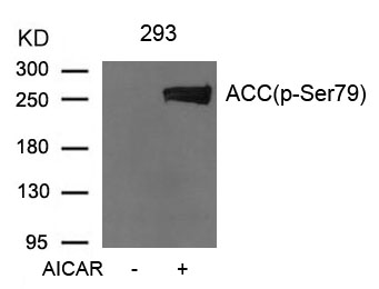 Rabbit Polyclonal Antibody to Acetyl-CoA Carboxylase (Phospho-Ser79)