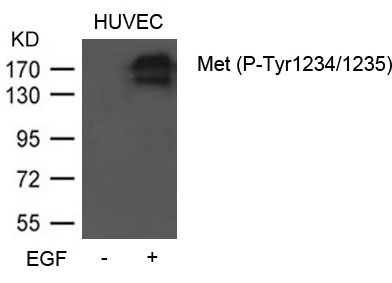Rabbit Polyclonal Antibody to Met (Phospho-Tyr1234/1235)