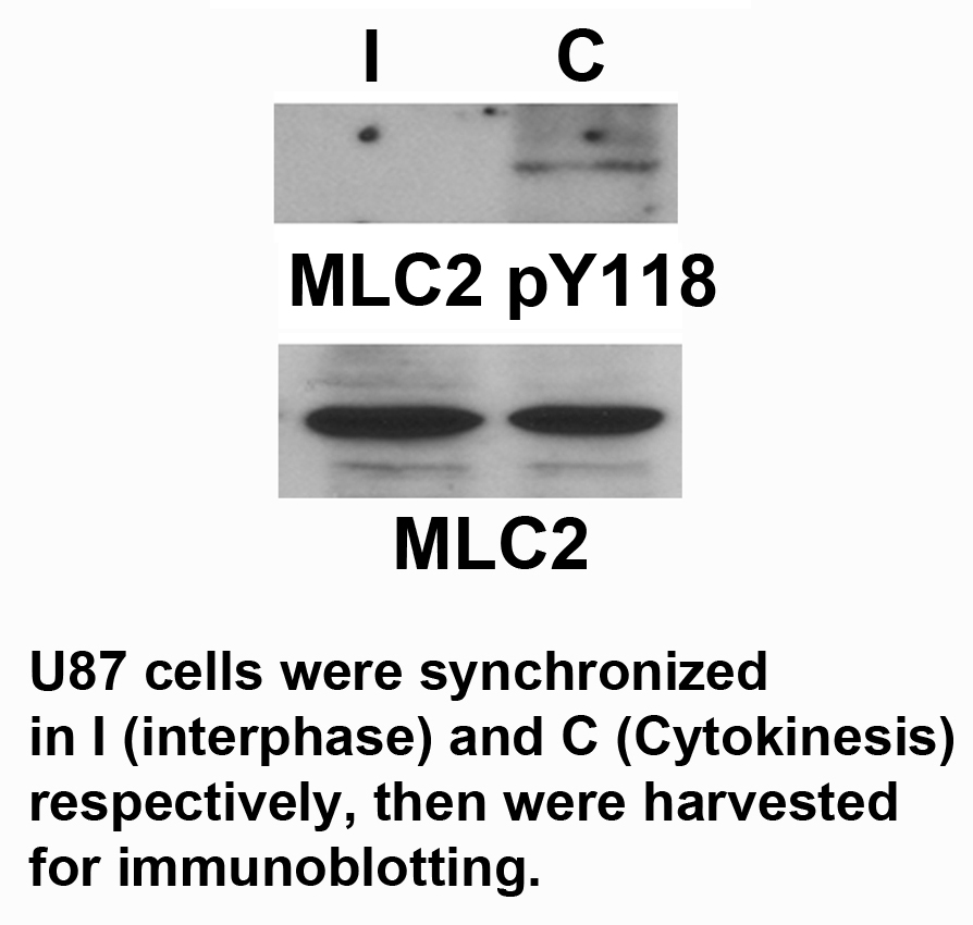 Rabbit Polyclonal Antibody to MLC2 (Phospho-Tyr118)