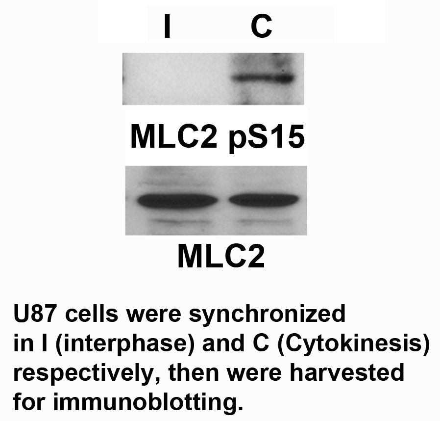 Rabbit Polyclonal Antibody to MLC2 (Phospho-Ser15)