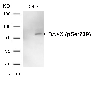 Rabbit Polyclonal Antibody to DAXX(Phospho-Ser739)