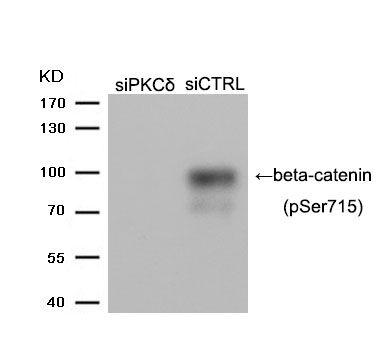 Rabbit Polyclonal Antibody to beta-catenin (Phospho-Ser715)
