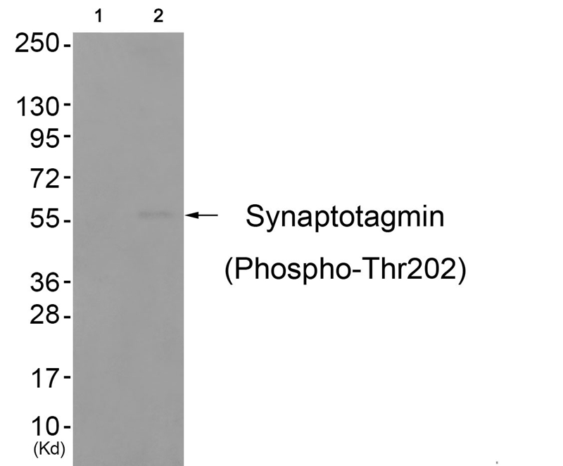 Rabbit Polyclonal Antibody to Synaptotagmin (Phospho-Thr202)
