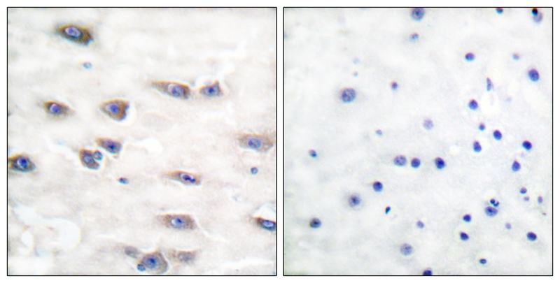 Rabbit Polyclonal Antibody to Trk A (Phospho-Tyr791)