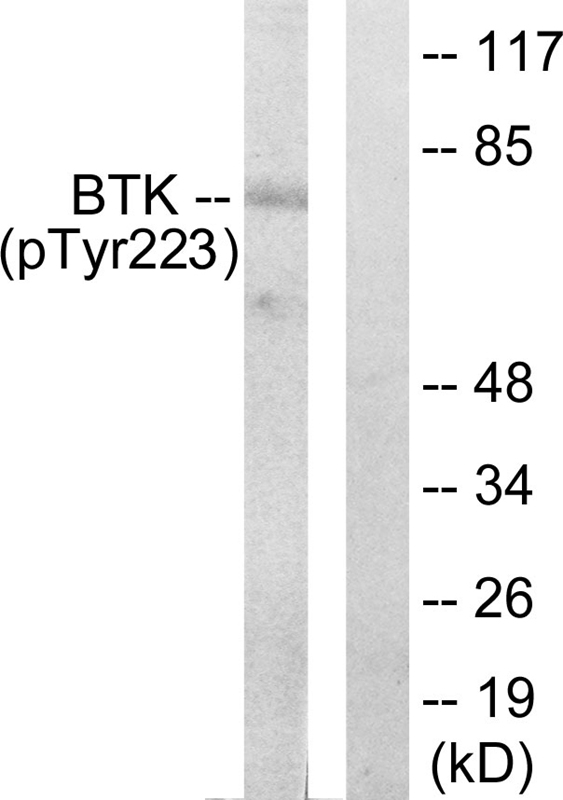 Rabbit Polyclonal Antibody to BTK (Phospho-Tyr223)