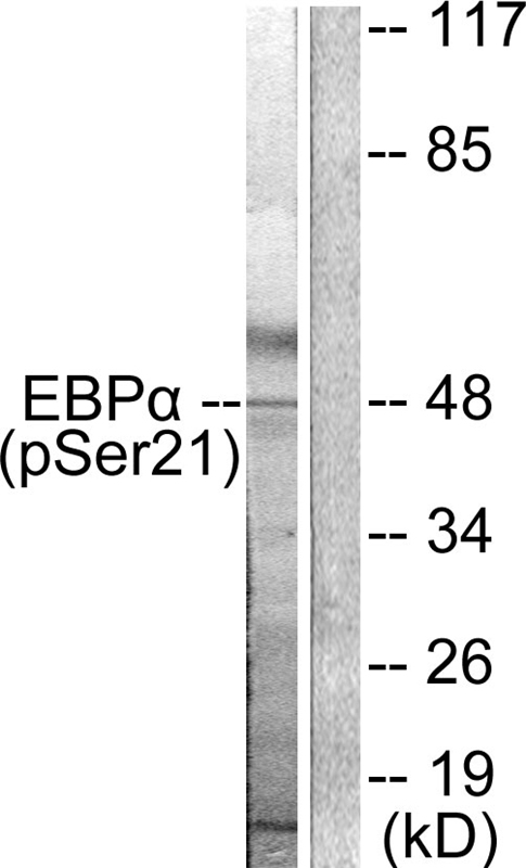 Rabbit Polyclonal Antibody to C/EBP-α (Phospho-Ser21)