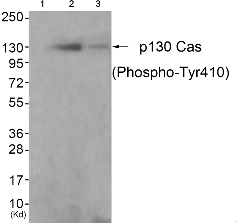Rabbit Polyclonal Antibody to p13Cas (Phospho-Tyr410)