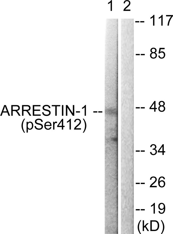Rabbit Polyclonal Antibody to Arrestin 1 (Phospho-Ser412)