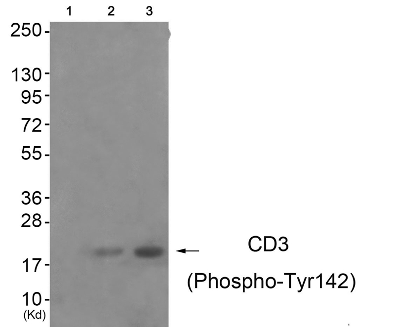 Rabbit Polyclonal Antibody to CD3 ζ (Phospho-Tyr142)