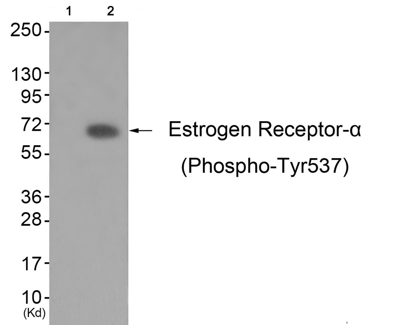 Rabbit Polyclonal Antibody to Estrogen Receptor-α (Phospho-Tyr537)