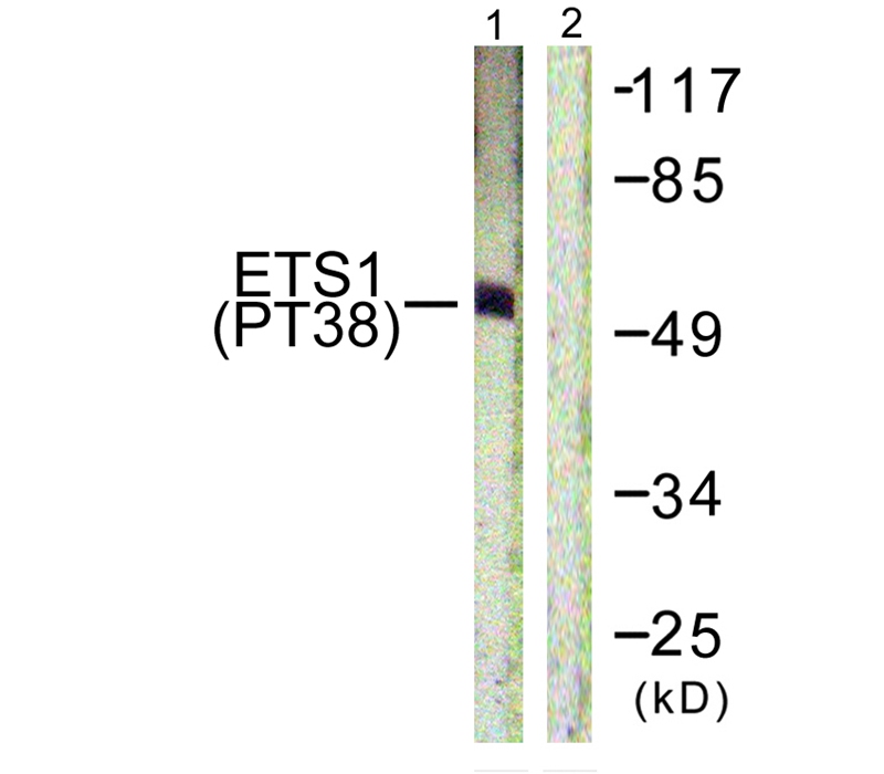 Rabbit Polyclonal Antibody to ETS1 (Phospho-Thr38)