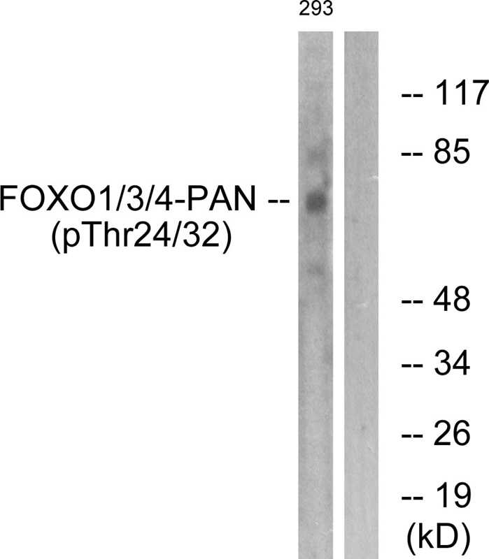 Rabbit Polyclonal Antibody to FOXO1/3/4-pan (Phospho-Thr24/32)