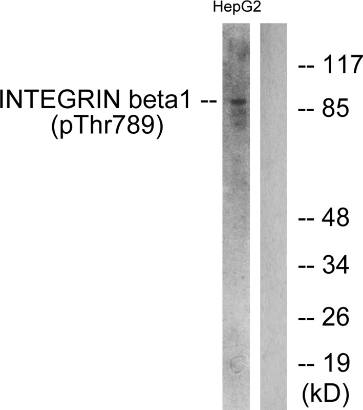 Rabbit Polyclonal Antibody to Integrin β1 (Phospho-Thr789)