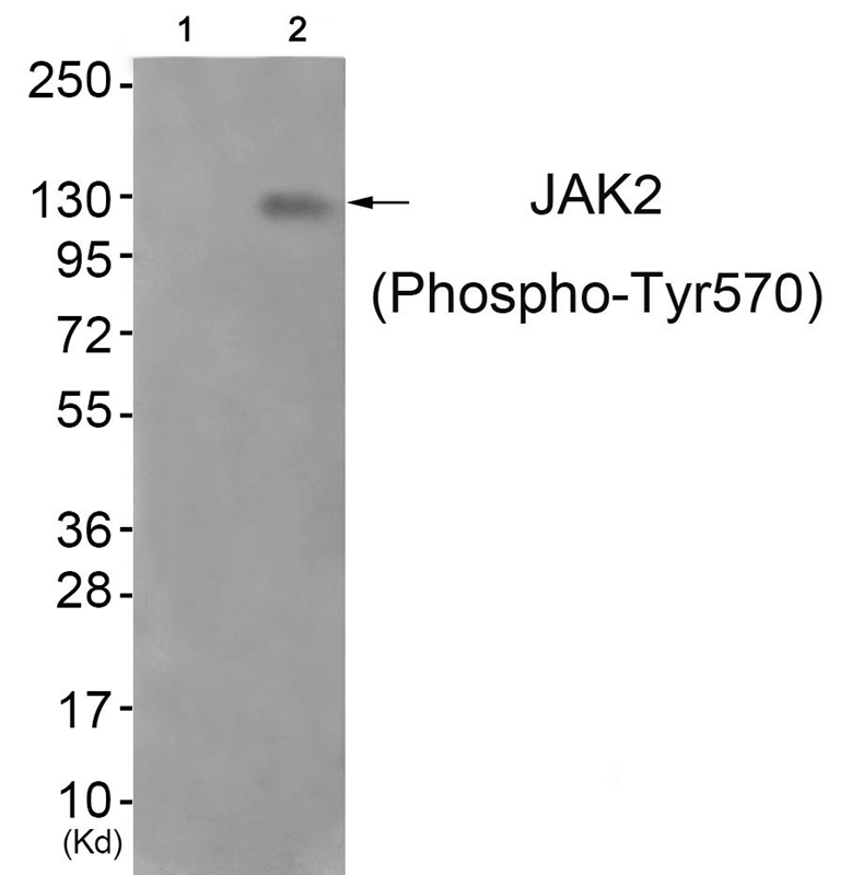 Rabbit Polyclonal Antibody to JAK2 (Phospho-Tyr570)