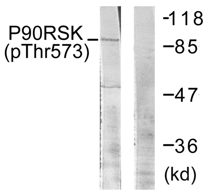 Rabbit Polyclonal Antibody to p9RSK (Phospho-Thr573)