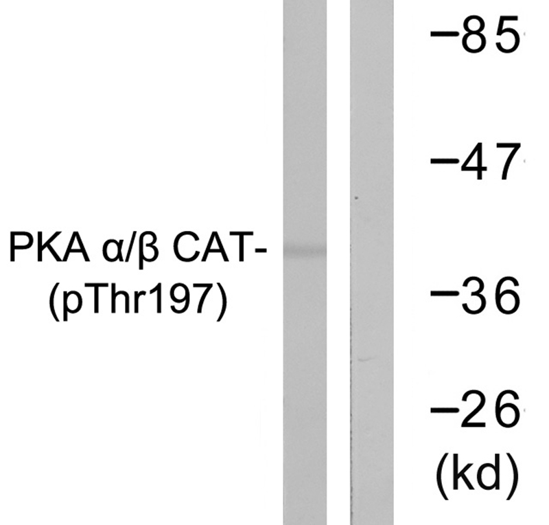 Rabbit Polyclonal Antibody to PKA α/β CAT (Phospho-Thr197)