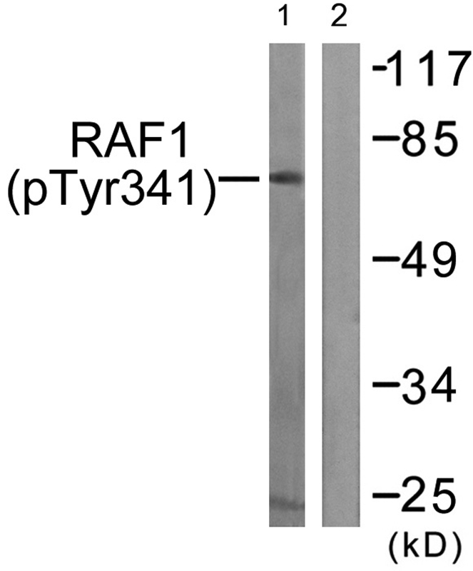 Rabbit Polyclonal Antibody to C-RAF (Phospho-Tyr341)