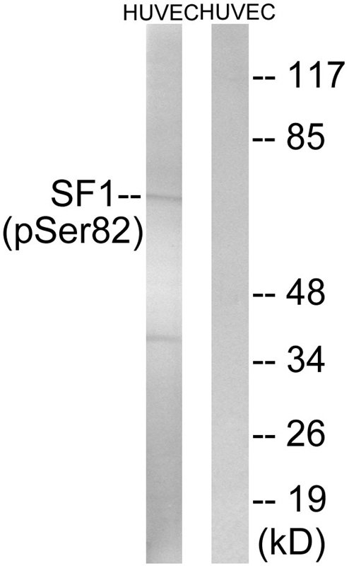 Rabbit Polyclonal Antibody to SF1 (Phospho-Ser82)