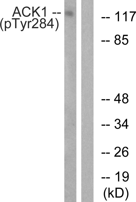Rabbit Polyclonal Antibody to ACK1 (Phospho-Tyr284)