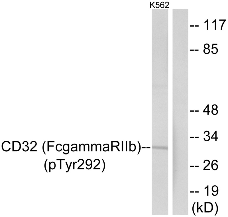 Rabbit Polyclonal Antibody to CD32 (Phospho-Tyr292)