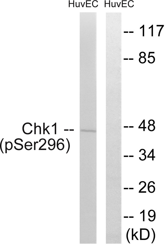 Rabbit Polyclonal Antibody to Chk1 (Phospho-Ser296)