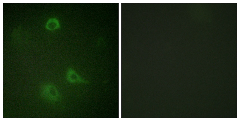 Rabbit Polyclonal Antibody to NMDAR1 (Phospho-Ser890)